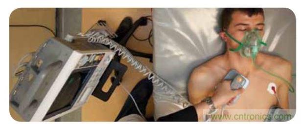 帶電極的醫(yī)院用除顫器。注意，患者身上有外部心電圖或心臟監(jiān)護儀，從胸部的白色圓片(電極)和導(dǎo)聯(lián)(線)可看出來。